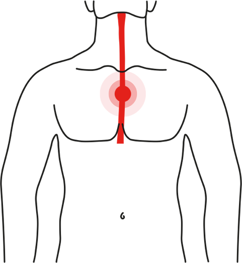 Icon of a person suffering from heartburn symptoms: burning sensation in chest and throat